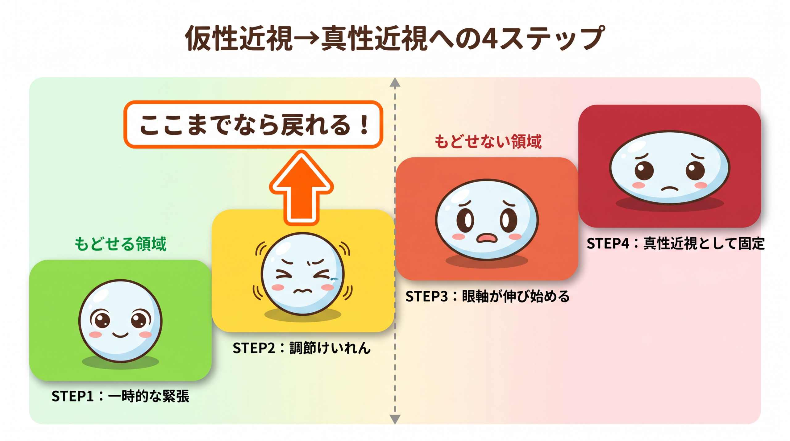 図解：仮性近視から真性近視への移行ステップ